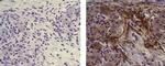 Mouse IgG (H+L) Secondary Antibody in Immunohistochemistry (Paraffin) (IHC (P))