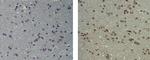 Mouse IgG (H+L) Secondary Antibody in Immunohistochemistry (Paraffin) (IHC (P))