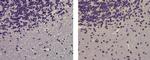 Mouse IgG (H+L) Secondary Antibody in Immunohistochemistry (Paraffin) (IHC (P))