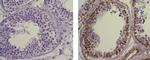 Mouse IgG1 kappa Isotype Control in Immunohistochemistry (Paraffin) (IHC (P))