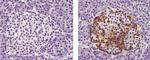 Mouse IgG1 kappa Isotype Control in Immunohistochemistry (Paraffin) (IHC (P))