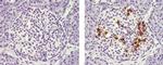 Mouse IgG1 kappa Isotype Control in Immunohistochemistry (Paraffin) (IHC (P))