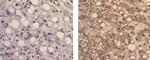 Mouse IgG1 kappa Isotype Control in Immunohistochemistry (Paraffin) (IHC (P))