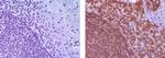 Rat IgG (H+L) Secondary Antibody in Immunohistochemistry (Paraffin) (IHC (P))