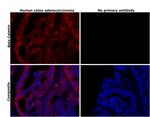 beta Catenin Antibody in Immunohistochemistry (Paraffin) (IHC (P))