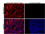 beta Catenin Antibody in Immunohistochemistry (Paraffin) (IHC (P))