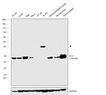 Bcl-2 Antibody