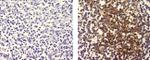 FDC Antibody in Immunohistochemistry (Paraffin) (IHC (P))