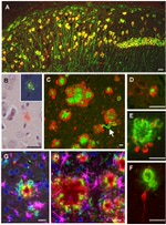 Amyloid Precursor Protein Antibody in Immunocytochemistry (ICC/IF)