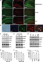 Amyloid Precursor Protein Antibody in Western Blot (WB)