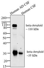 Amyloid Precursor Protein Antibody in Western Blot (WB)