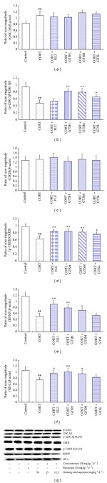 NEFL Antibody in Western Blot (WB)