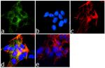 MAP2 Antibody in Immunocytochemistry (ICC/IF)