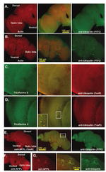 Ubiquitin Antibody in Immunohistochemistry (IHC)