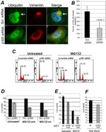 Ubiquitin Antibody in Immunocytochemistry (ICC/IF)