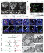 Podoplanin Antibody in Immunohistochemistry (IHC)