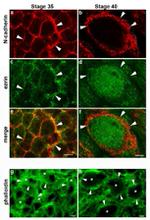 N-cadherin Antibody in Immunocytochemistry (ICC/IF)