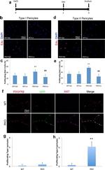 CD140b (PDGFRB) Antibody in Immunohistochemistry (IHC)