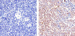 STAT5 alpha Antibody in Immunohistochemistry (Paraffin) (IHC (P))