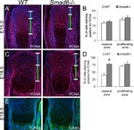 PCNA Antibody in Immunohistochemistry (IHC)