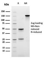 Carboxypeptidase A1/CPA1 Antibody in SDS-PAGE (SDS-PAGE)