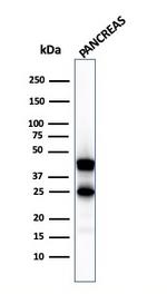 Carboxypeptidase A1/CPA1 Antibody in Western Blot (WB)