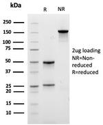 Carboxypeptidase A1/CPA1 Antibody in SDS-PAGE (SDS-PAGE)