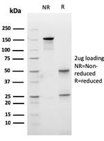 Carboxypeptidase A1/CPA1 Antibody in SDS-PAGE (SDS-PAGE)