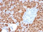 Carboxypeptidase A1/CPA1 Antibody in Immunohistochemistry (Paraffin) (IHC (P))