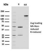 Carboxypeptidase A1/CPA1 Antibody in SDS-PAGE (SDS-PAGE)