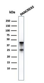 Carboxypeptidase A1/CPA1 Antibody in Western Blot (WB)