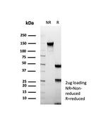 Carboxypeptidase A1/CPA1 (Pancreatic Cancer Marker) Antibody in SDS-PAGE (SDS-PAGE)