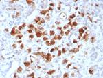 Carboxypeptidase A1/CPA1 (Pancreatic Cancer Marker) Antibody in Immunohistochemistry (Paraffin) (IHC (P))