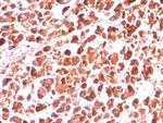 Carboxypeptidase A1/CPA1 (Pancreatic Cancer Marker) Antibody in Immunohistochemistry (Paraffin) (IHC (P))