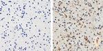 Tau Antibody in Immunohistochemistry (Paraffin) (IHC (P))