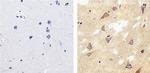 Tau Antibody in Immunohistochemistry (Paraffin) (IHC (P))