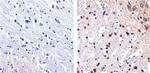 Tau Antibody in Immunohistochemistry (Paraffin) (IHC (P))