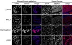 CD44var (v6) Antibody in Immunohistochemistry (IHC)