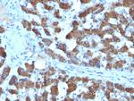 CPS1/Carbamoyl-Phosphate Synthetase (Hepatocellular Marker) Antibody in Immunohistochemistry (Paraffin) (IHC (P))