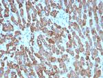 CPS1/Carbamoyl-Phosphate Synthetase (Hepatocellular Marker) Antibody in Immunohistochemistry (Paraffin) (IHC (P))