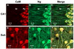 CaMKII alpha Antibody in Immunohistochemistry (IHC)