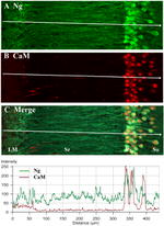 CaMKII alpha Antibody in Immunohistochemistry (IHC)