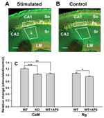 CaMKII alpha Antibody in Immunohistochemistry (IHC)