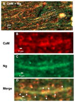 CaMKII alpha Antibody in Immunohistochemistry (IHC)