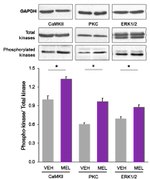 CaMKII alpha Antibody in Western Blot (WB)