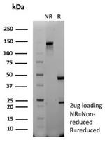 CD35/CR1 (Follicular Dendritic Cell Marker) Antibody in SDS-PAGE (SDS-PAGE)