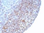 CD35/CR1 (Follicular Dendritic Cell Marker) Antibody in Immunohistochemistry (Paraffin) (IHC (P))