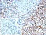 CD35/CR1 (Follicular Dendritic Cell Marker) Antibody in Immunohistochemistry (Paraffin) (IHC (P))