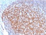 CD35/CR1 (Follicular Dendritic Cell Marker) Antibody in Immunohistochemistry (Paraffin) (IHC (P))