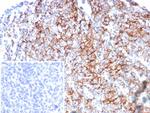 CD35/CR1 (Follicular Dendritic Cell Marker) Antibody in Immunohistochemistry (Paraffin) (IHC (P))